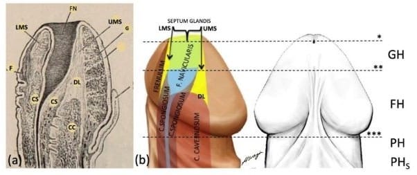 Anatomik sınır çizgilerine ve penis bağ dokusu yapısına göre hipospadias sınıflandırması şeması