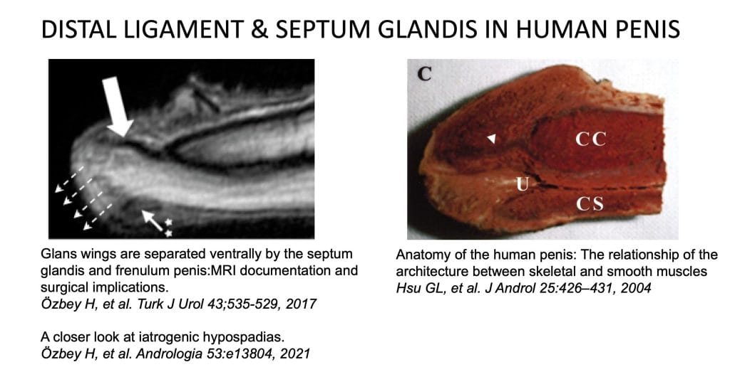 İnsan penisinde distal ligament ve septum glandis bağ dokusu ilişkisi