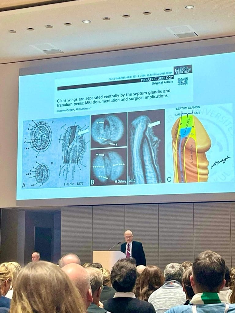 Prof. Dr. Hüseyin Özbey - Alman Çocuk Ürolojisi Yıllık Toplantısı Sunumu, Dortmund, Almanya (2025)